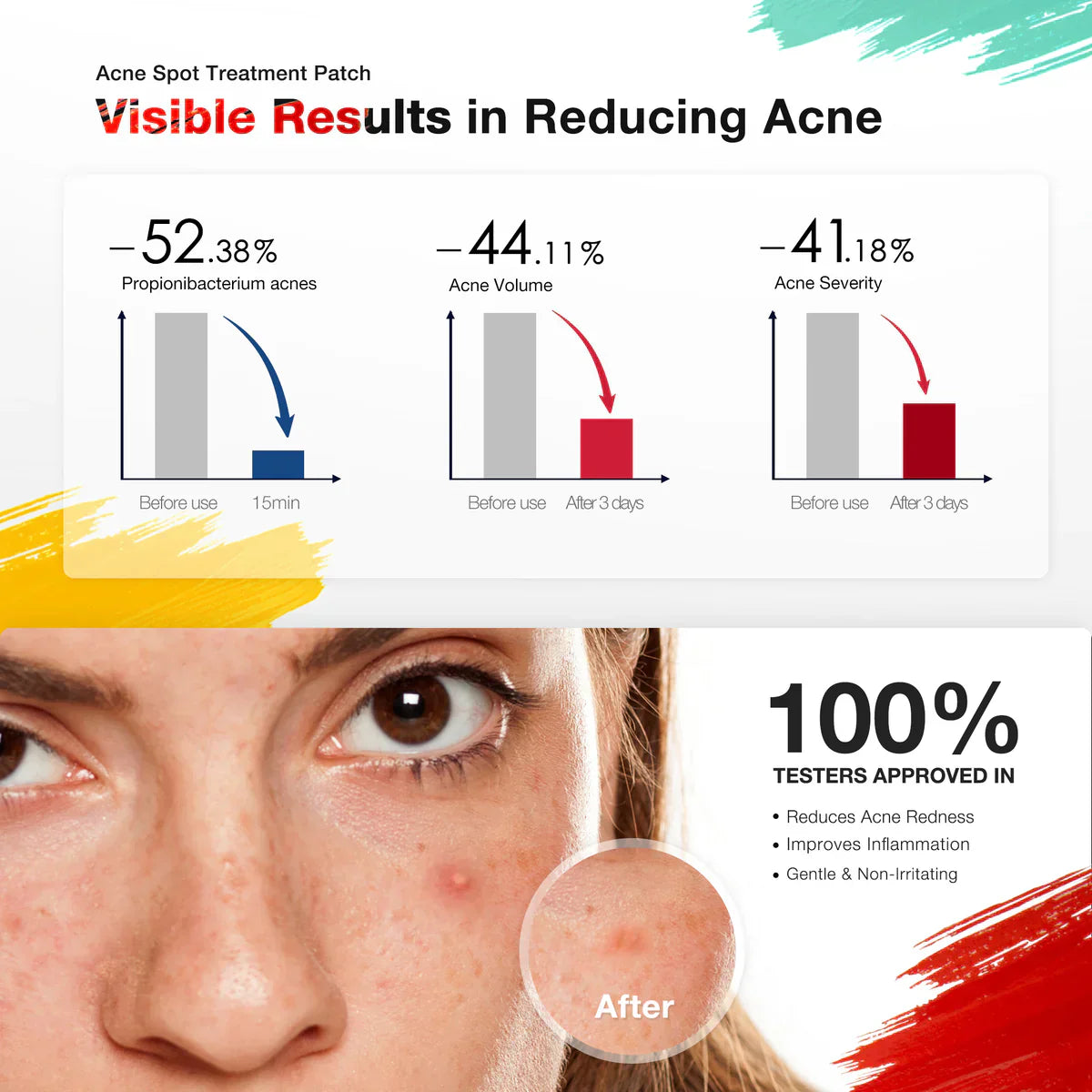 Electronic Acne Patches 6 pcs