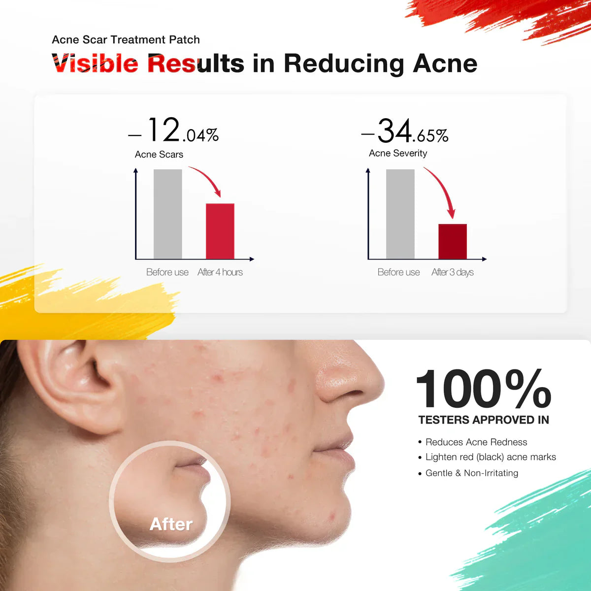 Electronic Acne Patches 6 pcs
