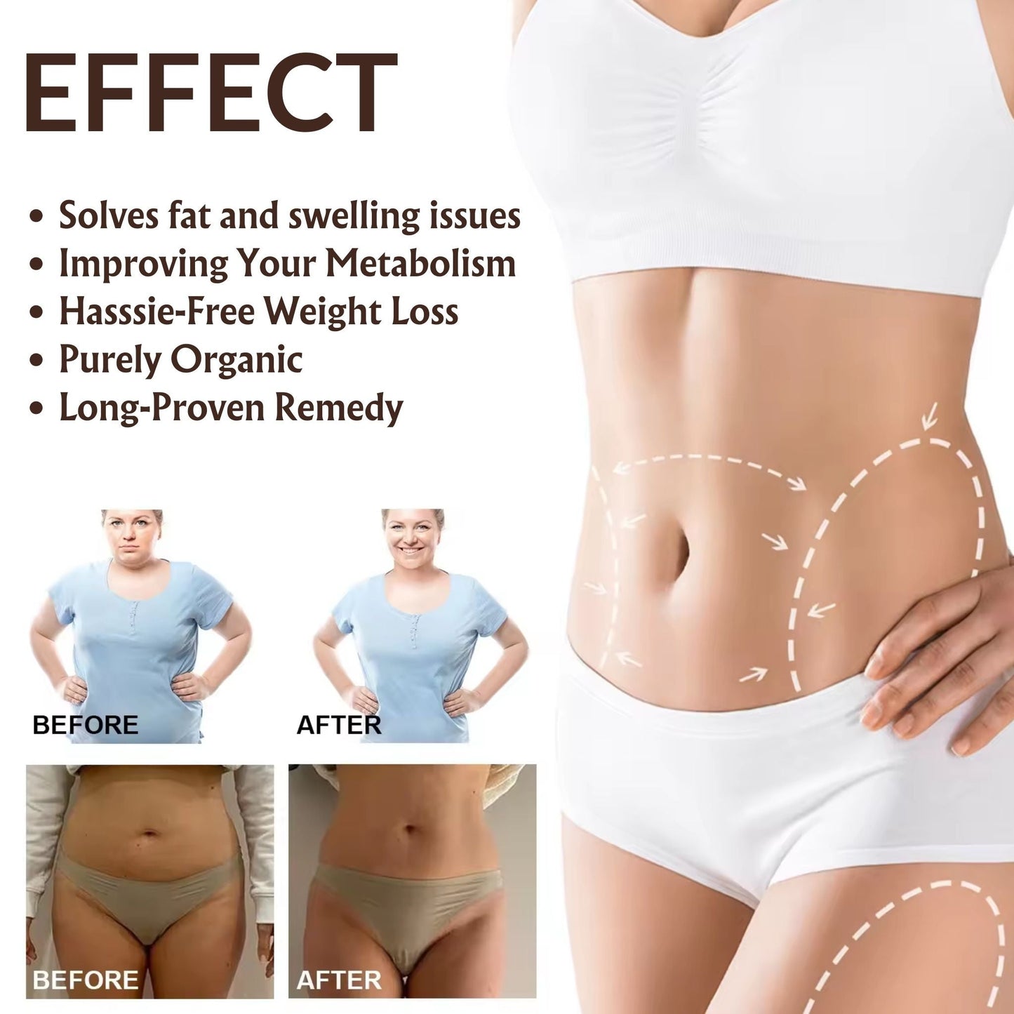 Silicone Anti Stretch Mark Stomach Patch