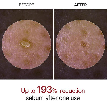 Dr. Melaxin Peel Shot Exfoliating White Rice Ampoule – Brightening & Gentle Peeling Serum