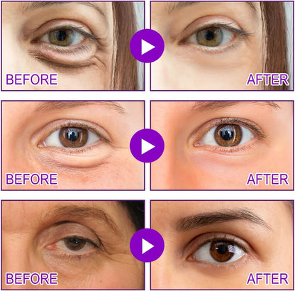 Microneedling Eye Patches (Pack of 4)