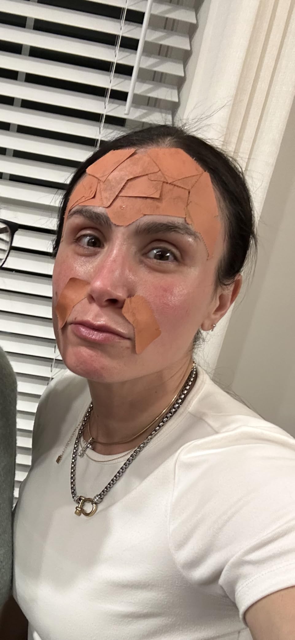lynn