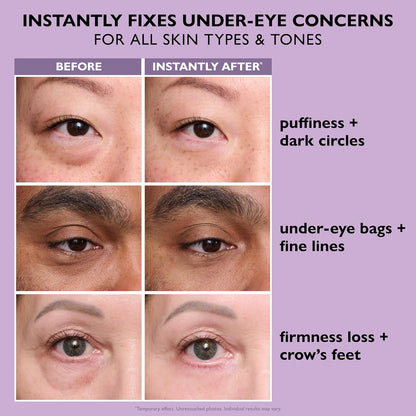 Peter Thomas Roth Instant FIRMx Eye Tightener – Temporary Under Eye Lifting & Smoothing Cream (20ml)