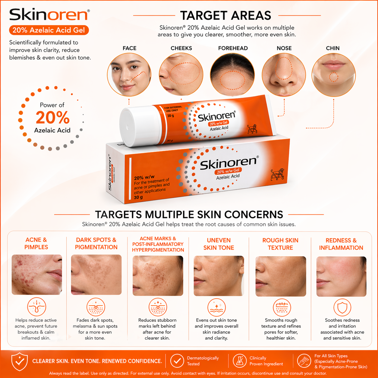 Skinoren Azelaic Acid 20% Cream (30g)