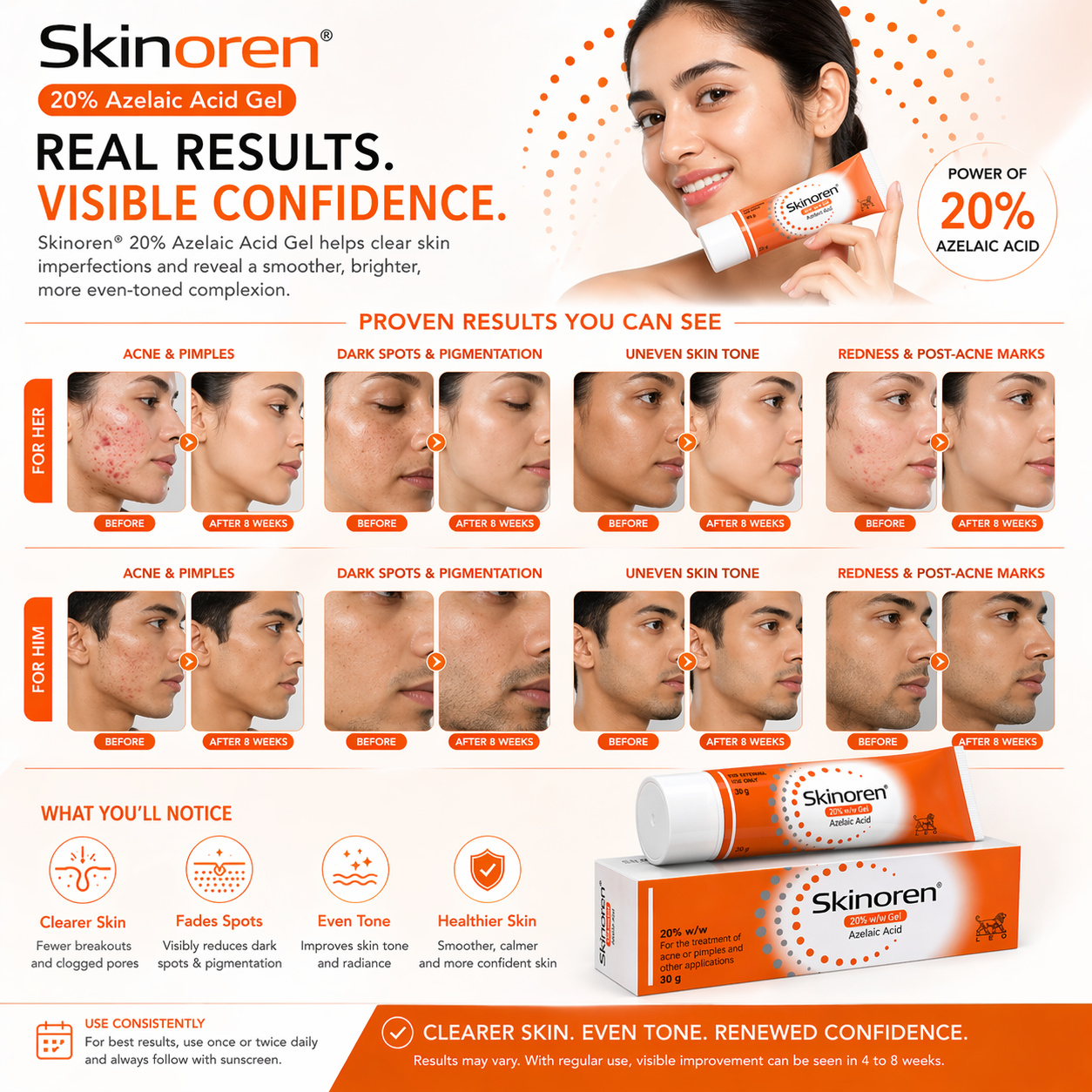 Skinoren Azelaic Acid 20% Cream (30g)