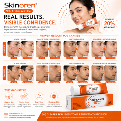 Skinoren Azelaic Acid 20% Cream (30g)