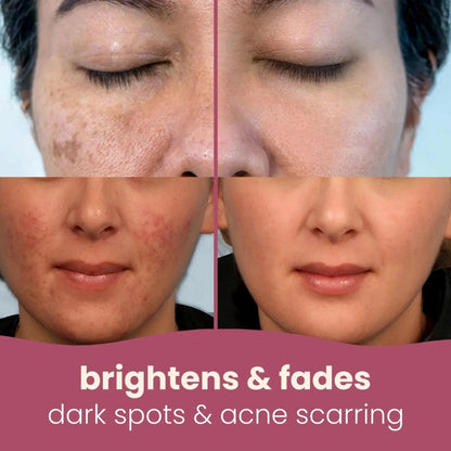 Turmeric Kojic Acid Pads